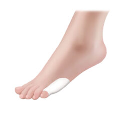 ΠΡΟΣΤΑΤΕΥΤΙΚΟ GEL ΜΙΚΡΟΥ ΔΑΚΤΥΛΟΥ