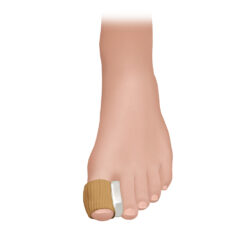 ΔΙΑΧΩΡΙΣΤΙΚΟ-ΠΡΟΣΤΑΤΕΥΤΙΚΟ ΔΑΚΤΥΛΩΝ